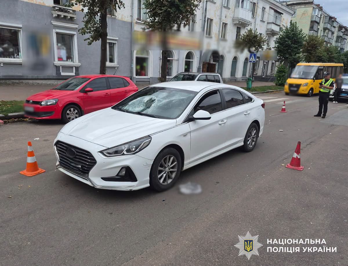 У Бердичеві 18-річний водій на Hyundai збив пенсіонера на «зебрі»: потерпілий у реанімації