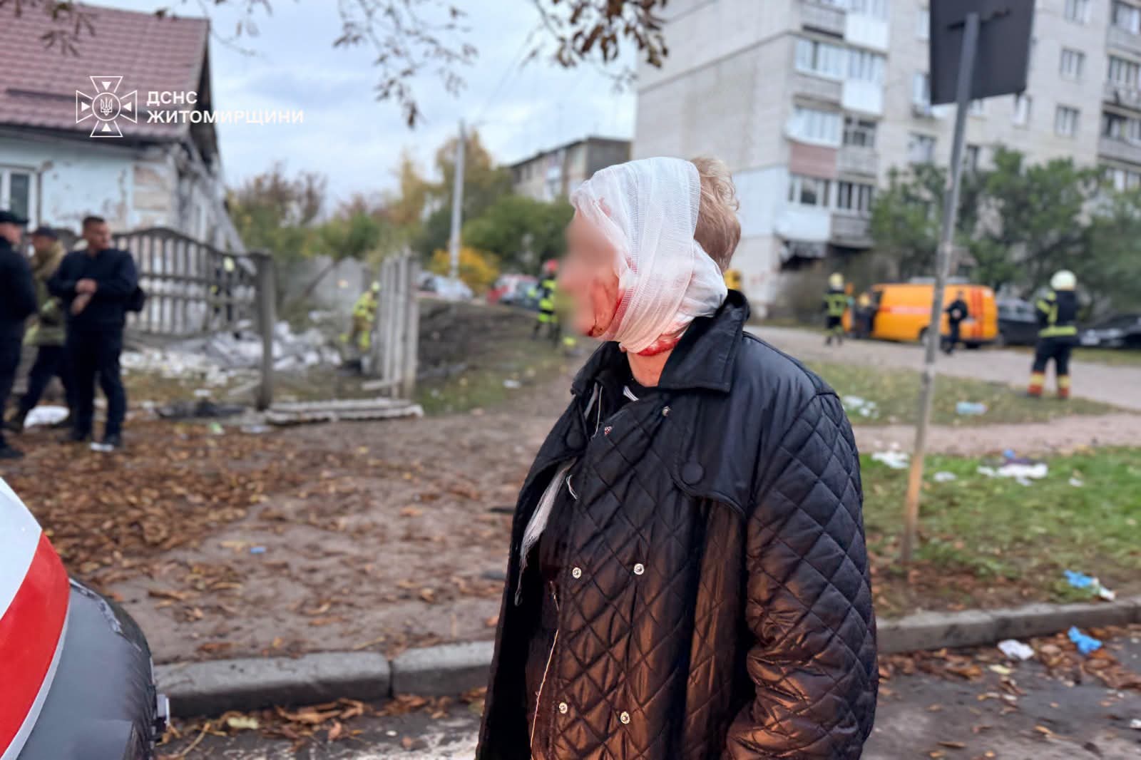 ДСНС показали наслідки ворожого удару по Житомиру: серед поранених — діти