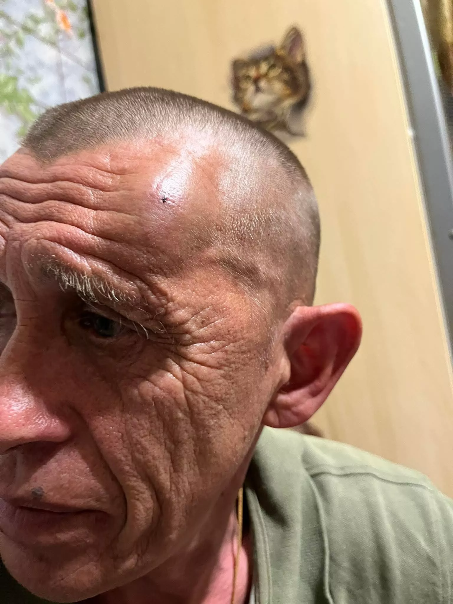 У Радомишлі невідомий напав на військового-пенсіонера, який повернувся на службу