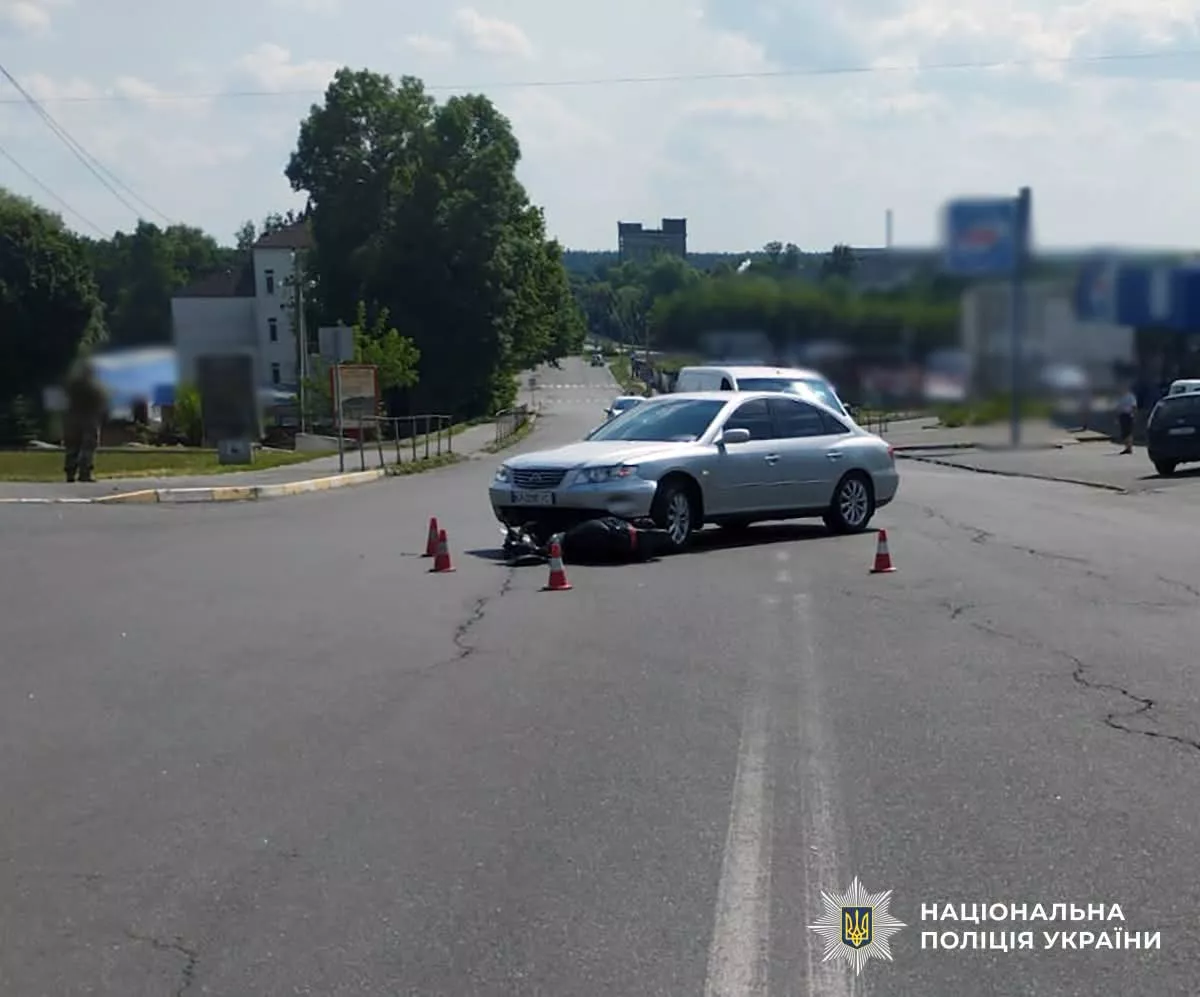 ДТП у Малині: під час зіткнення автомобіля зі скутером травмувалася жінка