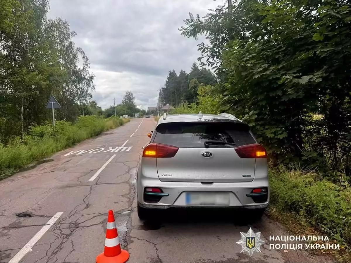 У Житомирі легковик збив 8-річного велосипедиста: дитину госпіталізували