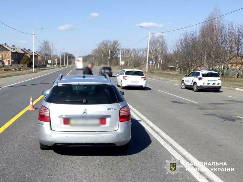 ДТП у Бердичівському районі: поліція розслідує наїзд на 11-річного хлопчика