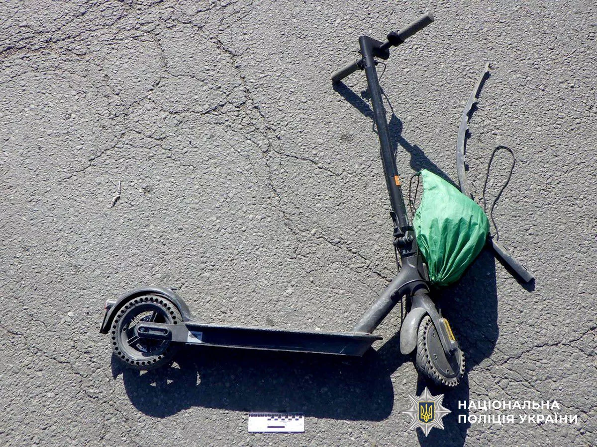 ДТП у Бердичівському районі: поліція розслідує наїзд на 11-річного хлопчика