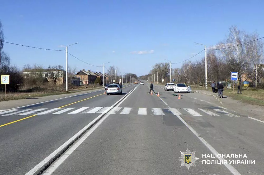 ДТП у Бердичівському районі: поліція розслідує наїзд на 11-річного хлопчика
