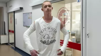 19-річний Богдан Гапій із Житомирщини вижив після 60% опіків: як лікарі Львова врятували хлопця