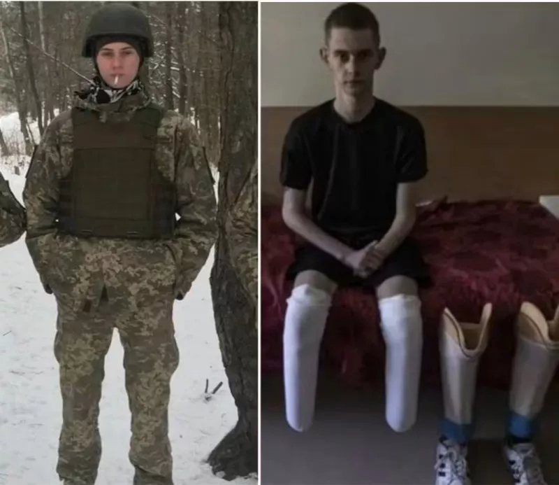 20-річний офіцер із Житомирщини пережив полон і важкі поранення